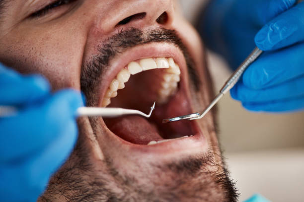 Best Root Canal Emergency Dentist  in Prairie Du Chien, WI